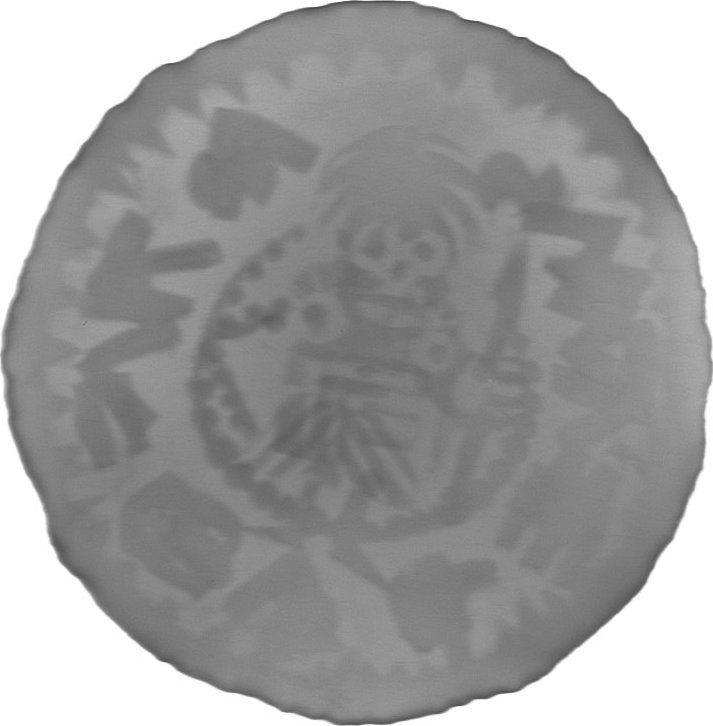 RTG snímek