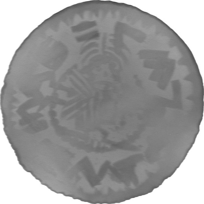 RTG snímek