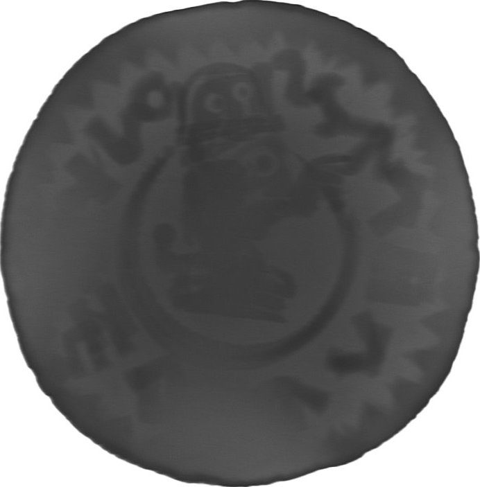 RTG snímek
