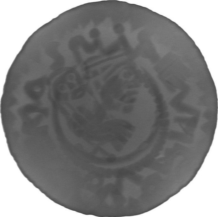 RTG snímek