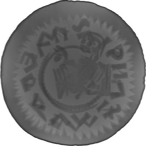 RTG snímek