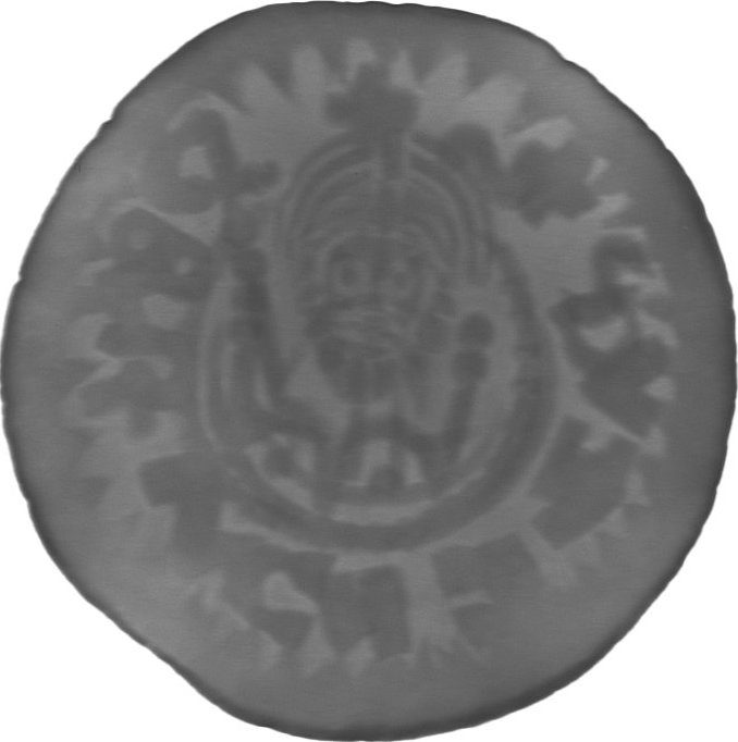 RTG snímek