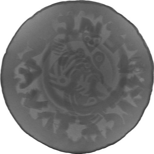 RTG snímek