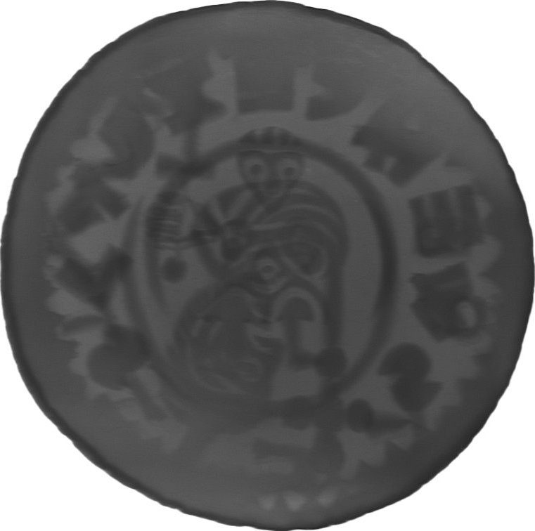 RTG snímek