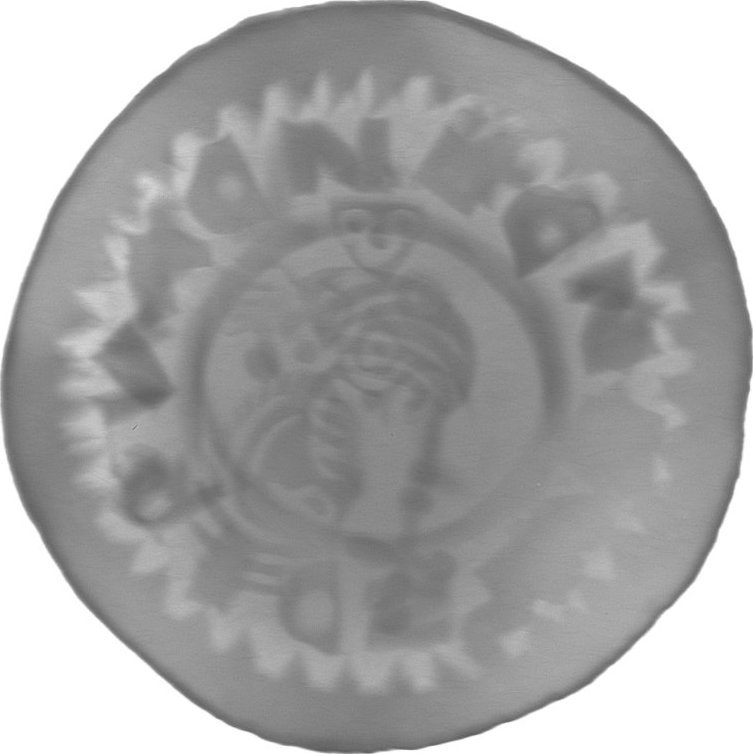 RTG snímek