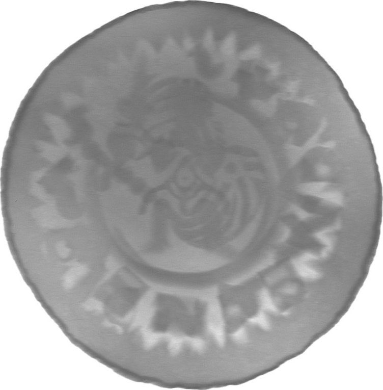 RTG snímek