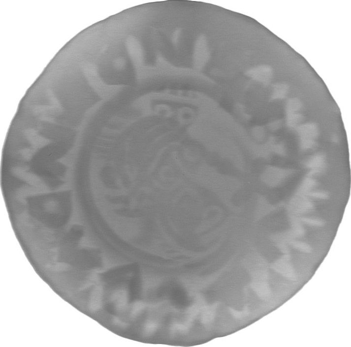 RTG snímek