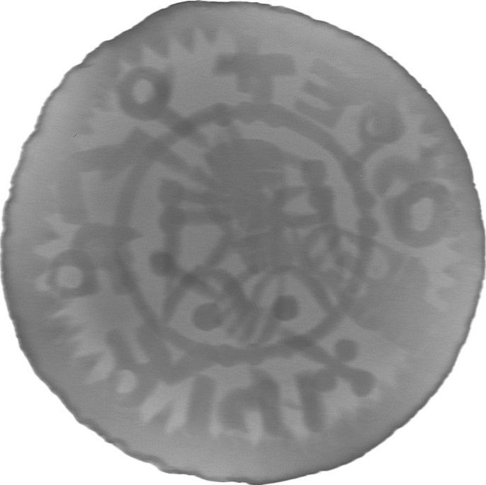 RTG snímek