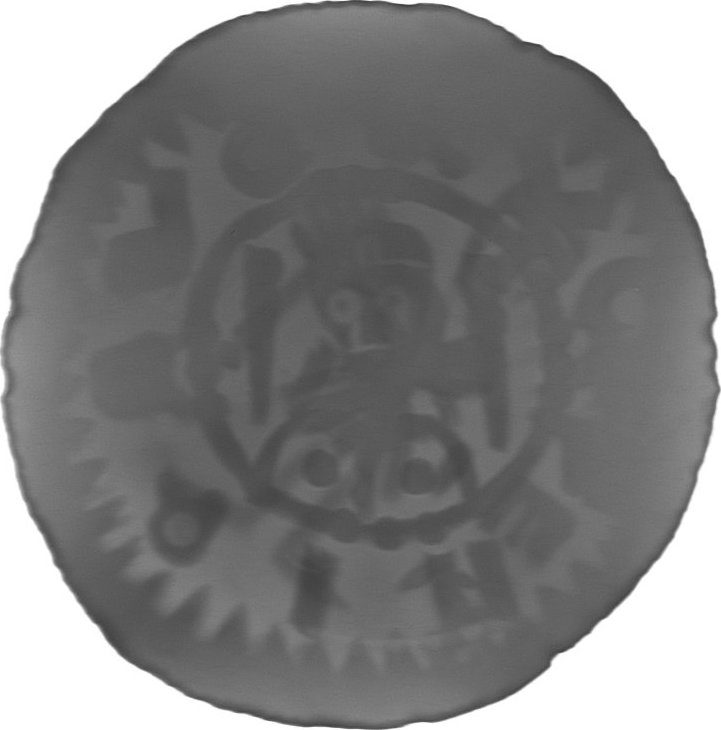 RTG snímek