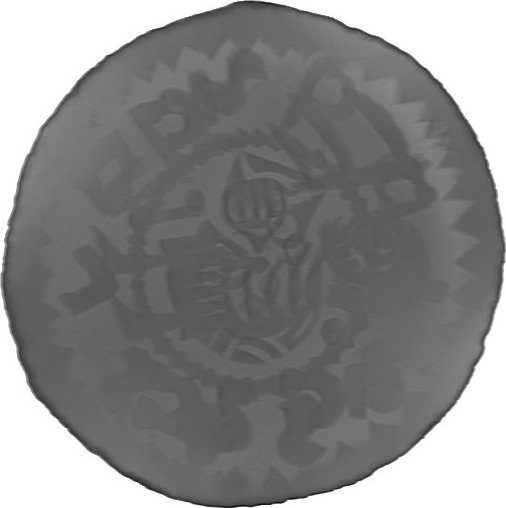RTG snímek
