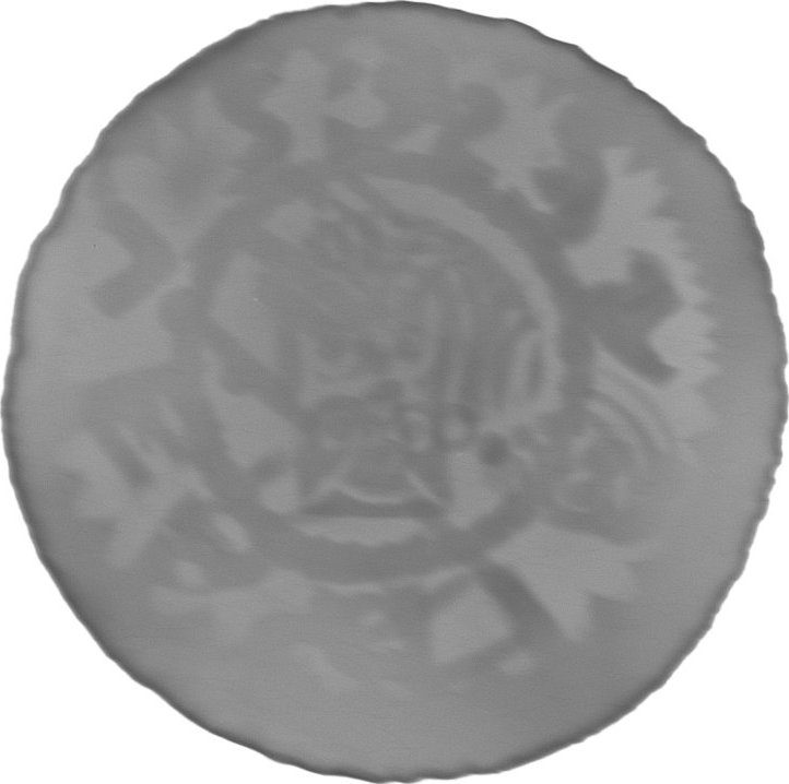 RTG snímek