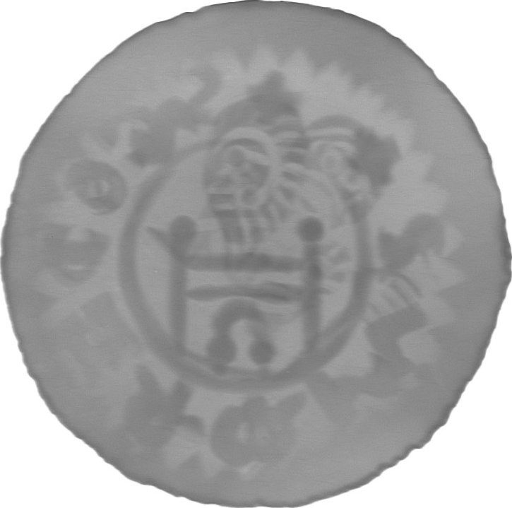 RTG snímek