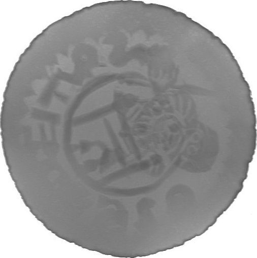 RTG snímek
