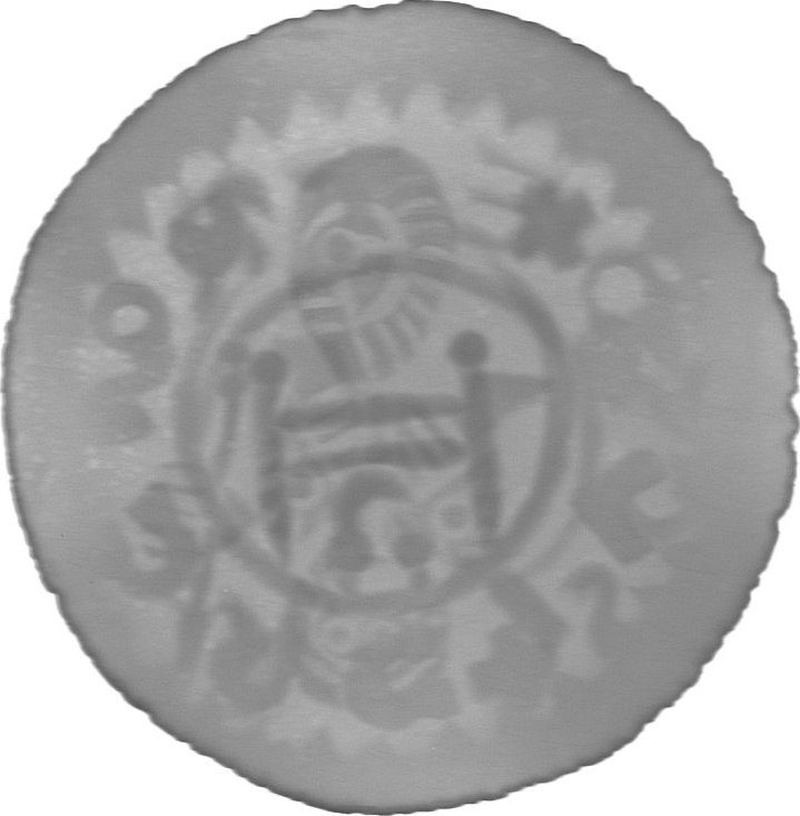RTG snímek