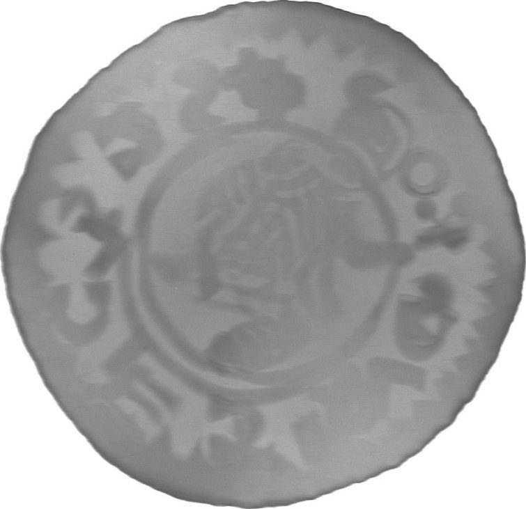 RTG snímek