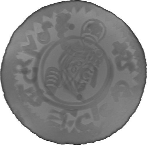RTG snímek