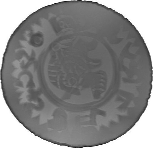 RTG snímek