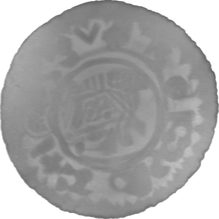 RTG snímek