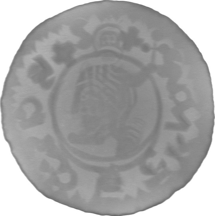 RTG snímek