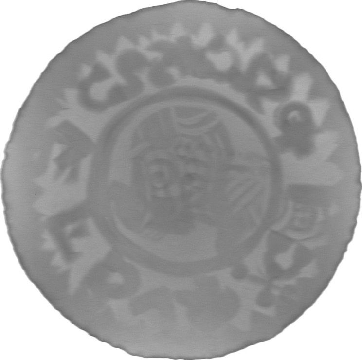 RTG snímek