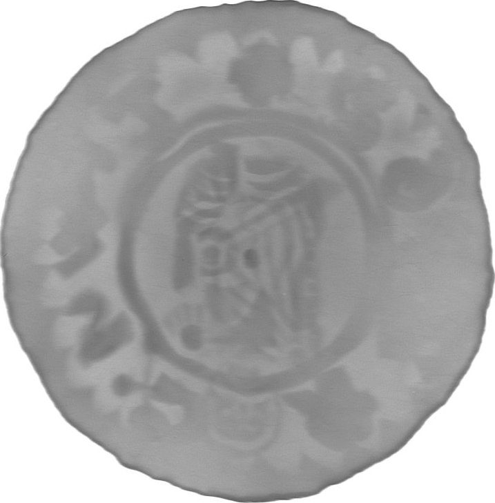RTG snímek