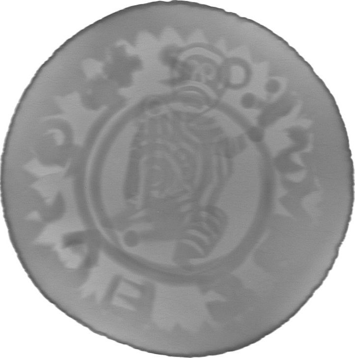 RTG snímek