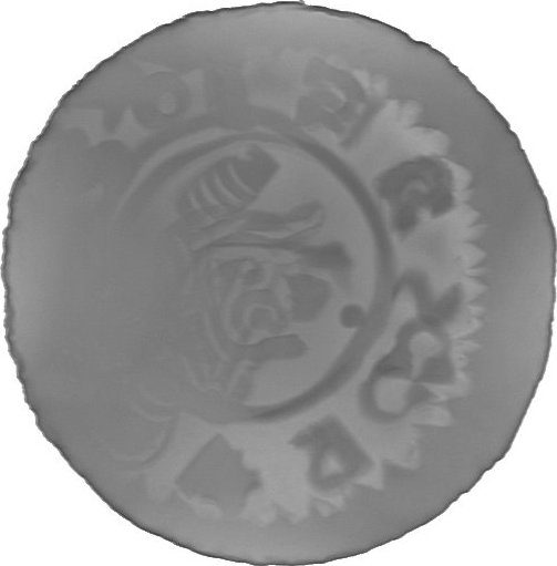 RTG snímek