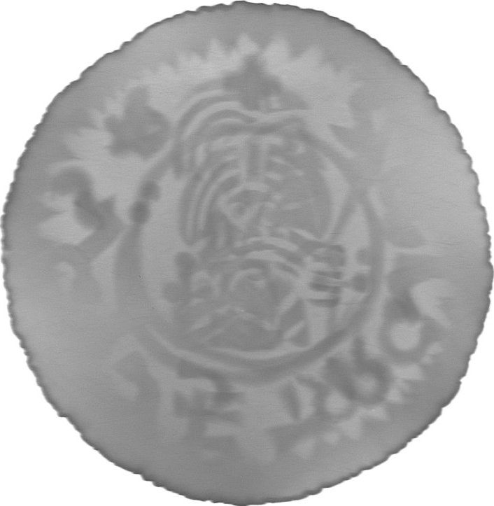 RTG snímek