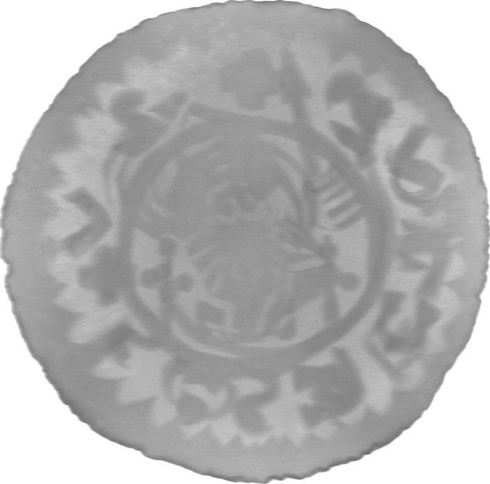 RTG snímek