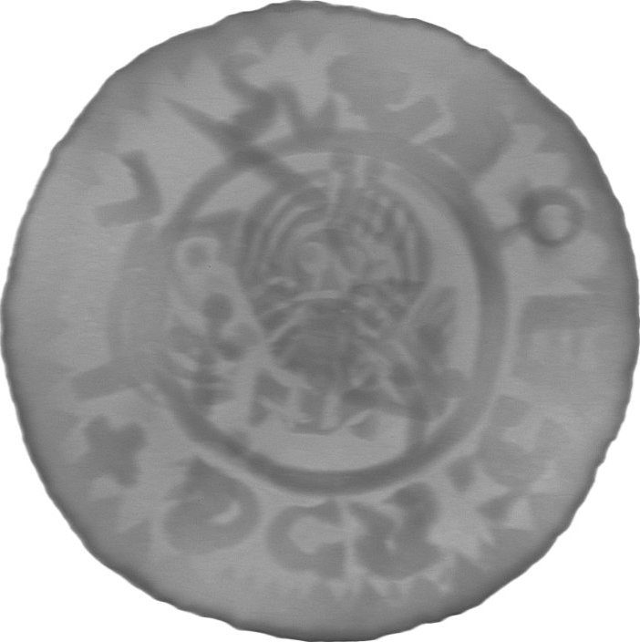 RTG snímek