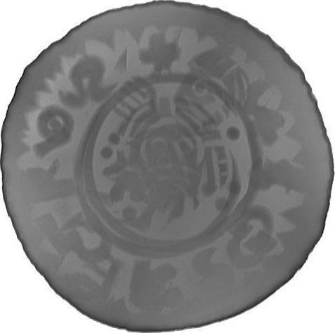 RTG snímek