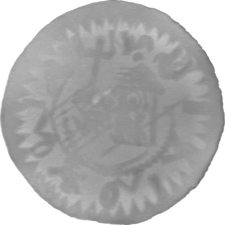 RTG snímek