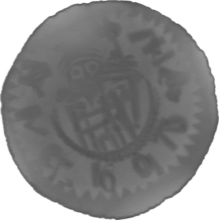 RTG snímek