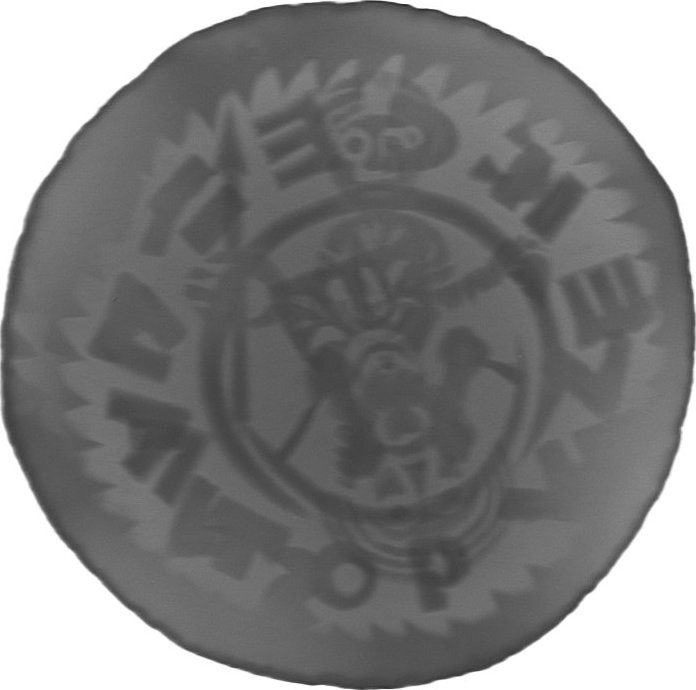 RTG snímek