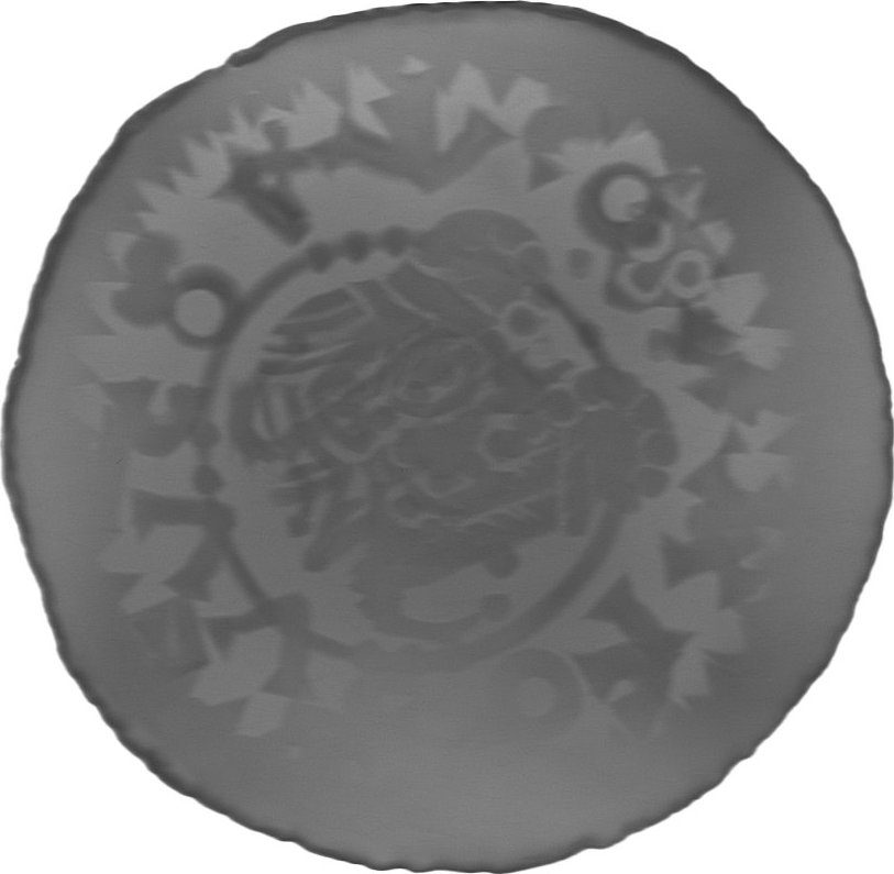 RTG snímek