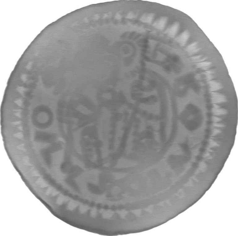 RTG snímek