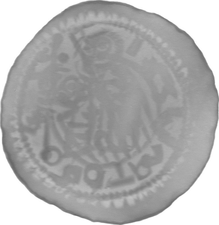 RTG snímek