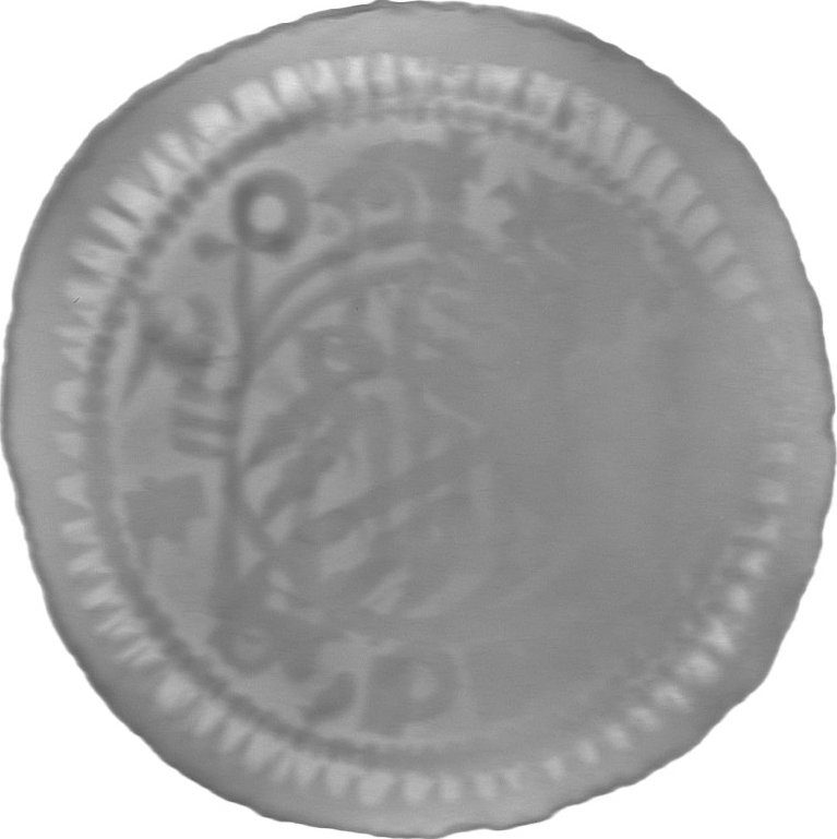RTG snímek