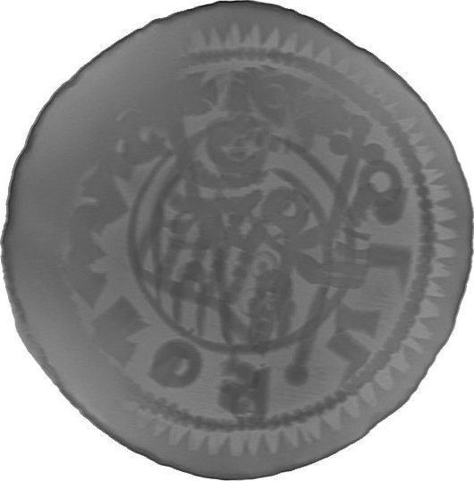 RTG snímek