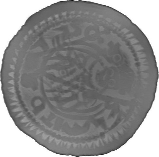 RTG snímek