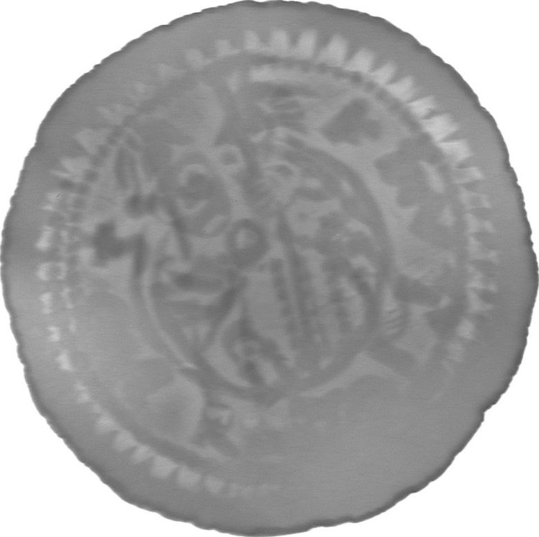 RTG snímek