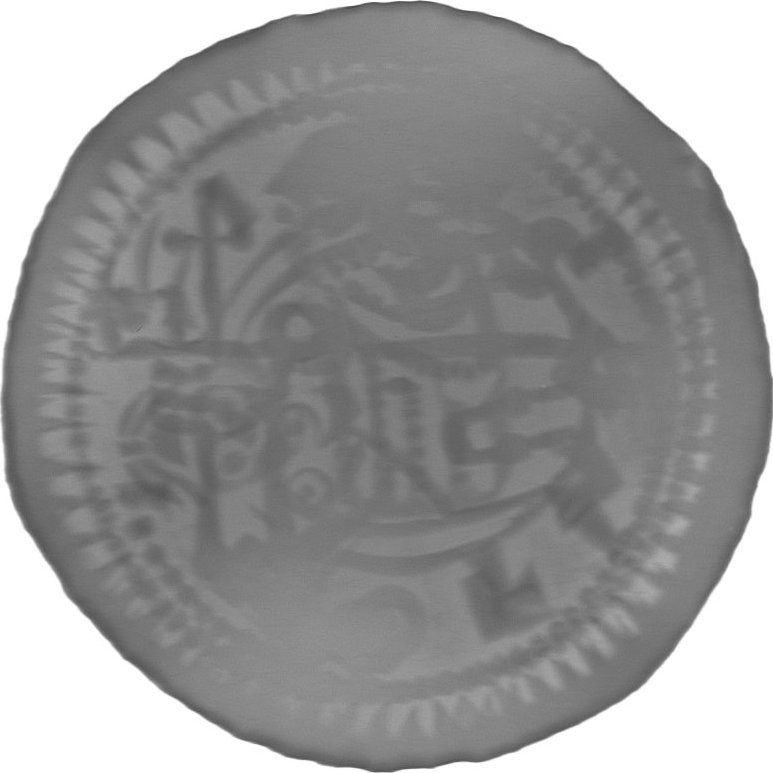 RTG snímek