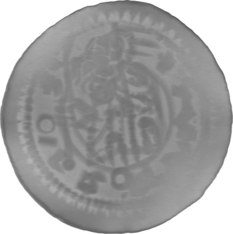 RTG snímek
