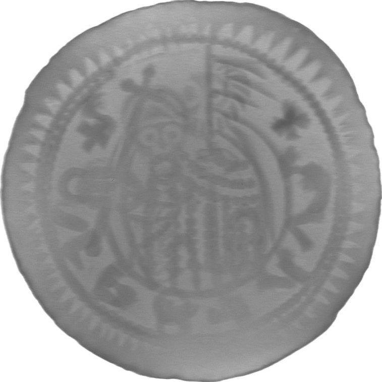 RTG snímek