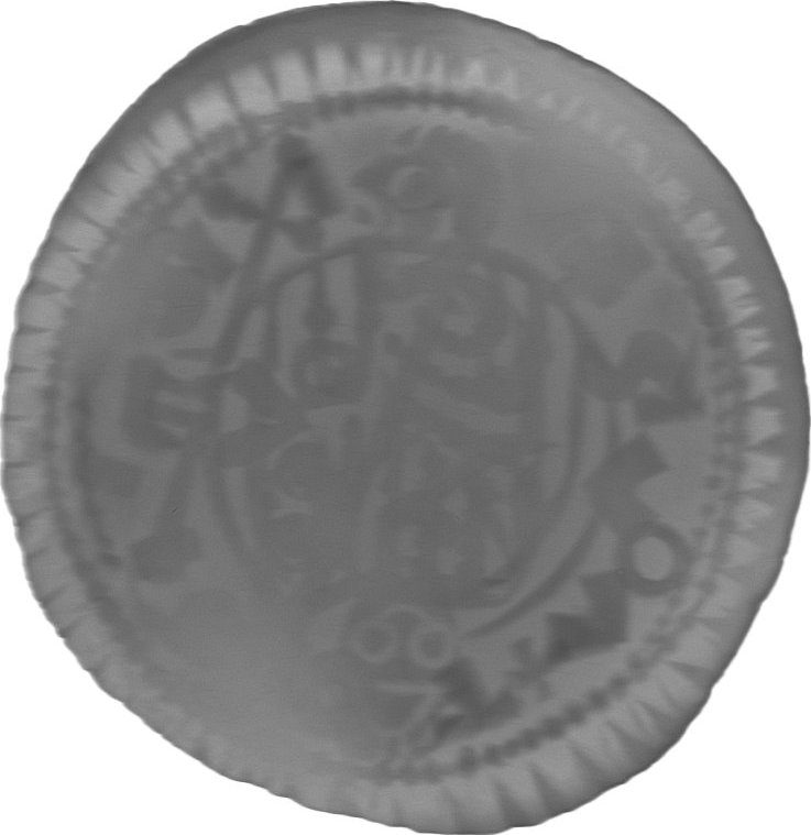 RTG snímek