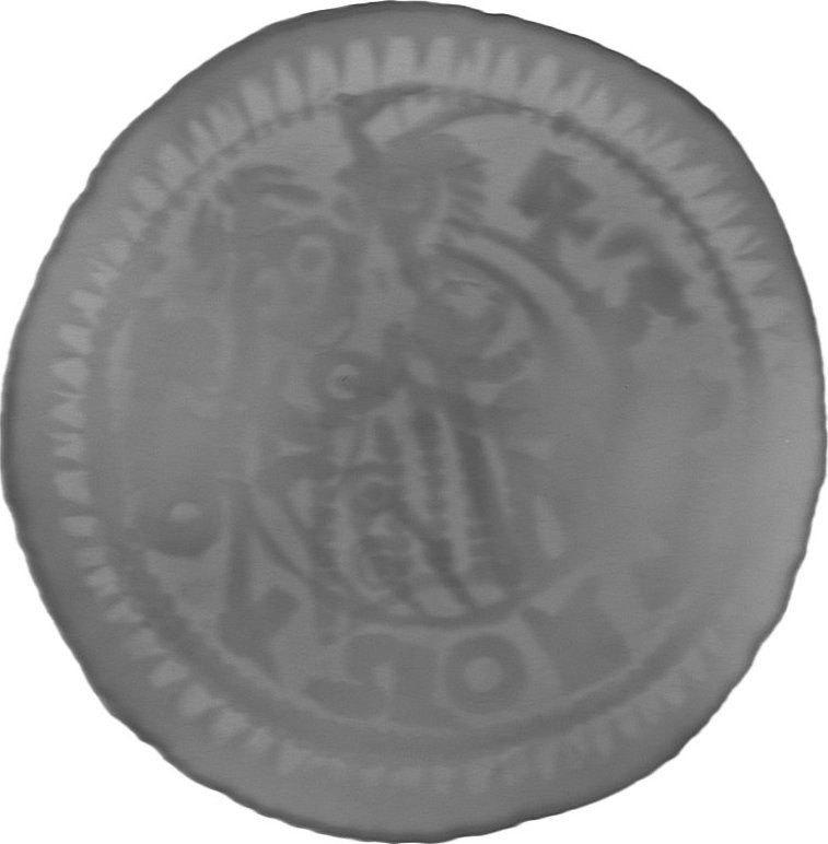 RTG snímek