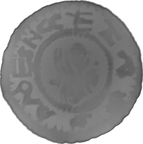 RTG snímek