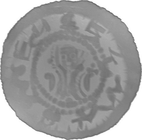 RTG snímek