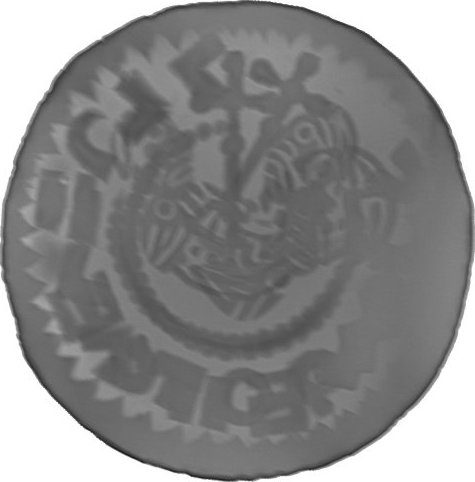 RTG snímek
