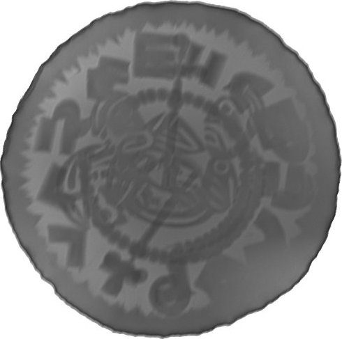 RTG snímek